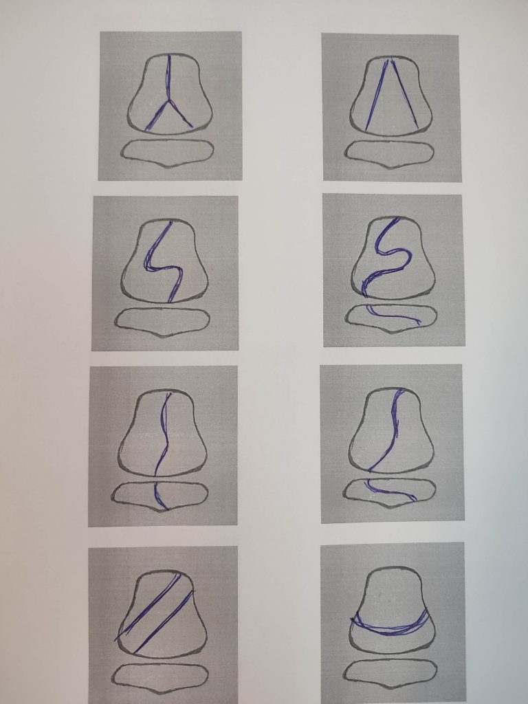 Historické skici designového řešení dětských židlí FUXO